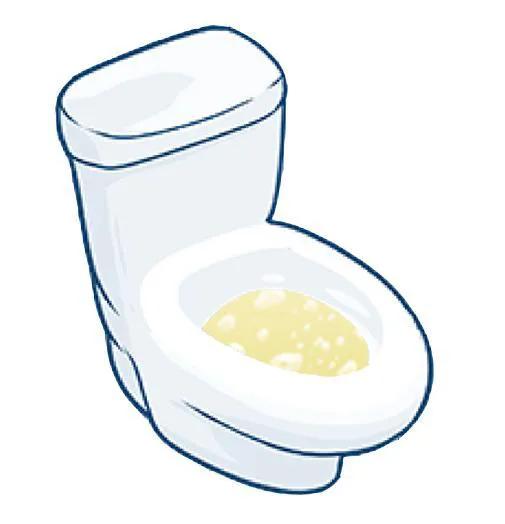 糖友泡沫尿,糖友尿中泡沫多是尿蛋白吗