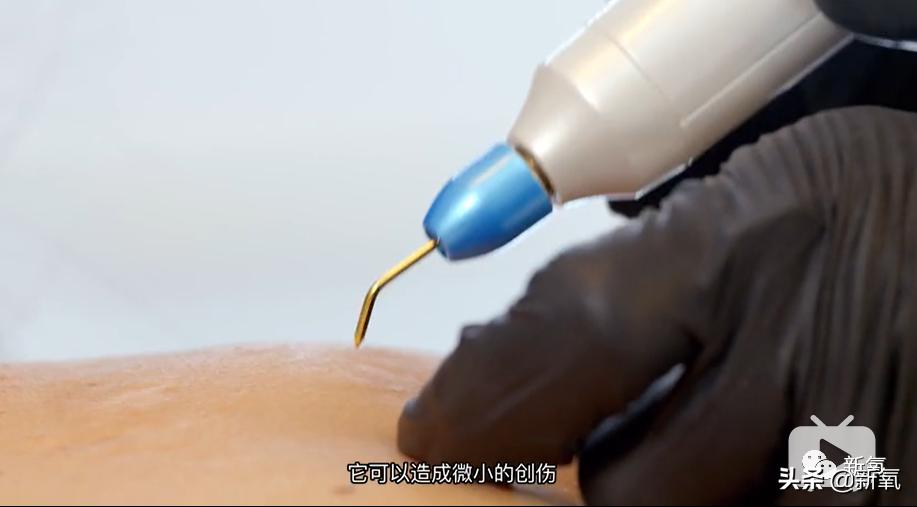 刘诗诗最近生图,刘诗诗旧照脸又胖又大