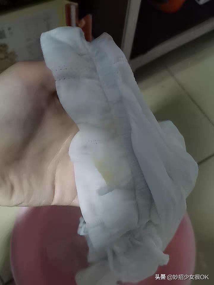 消毒液烧坏的衣服怎么补色,消毒液烧到皮肤了怎么办