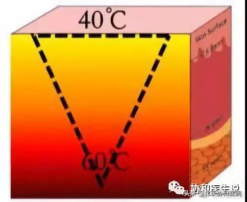 40岁女性适合的身体整形医美项目,40岁的女人整形手术