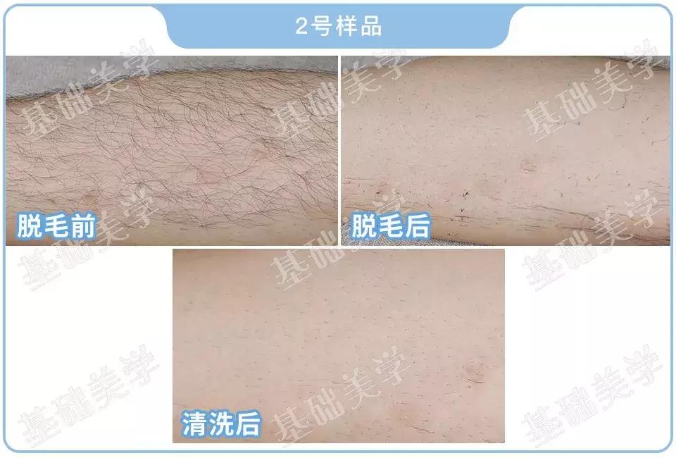 脱毛膏大评测，这个夏天让你不再“毛手毛脚”