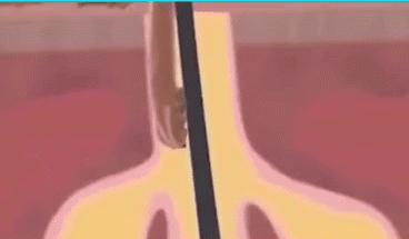 500万只螨虫陪你入睡,消除螨虫的100种方法