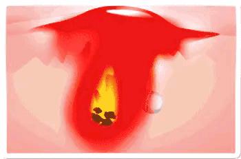 长期使用美容仪斑会淡吗,长期使用美容仪皮肤会提亮吗