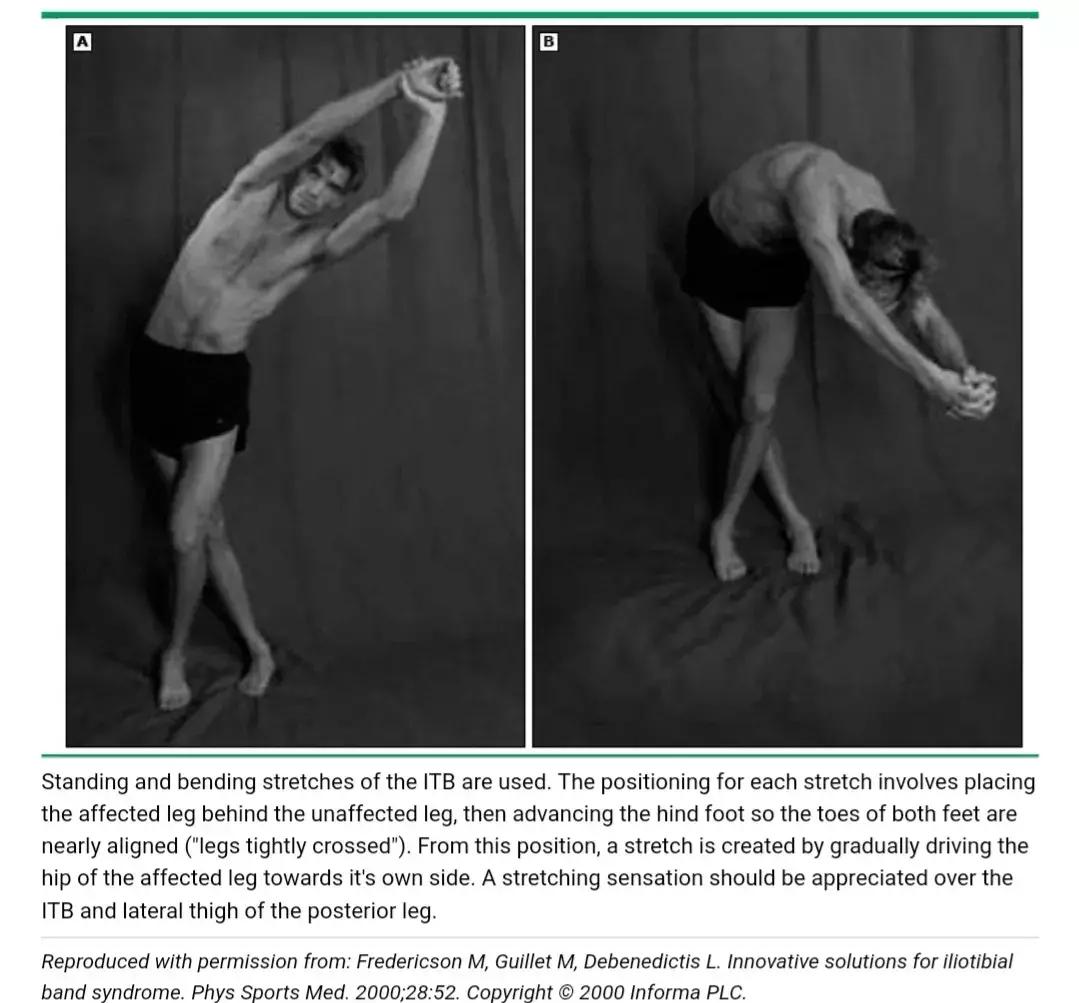 跑步膝盖髂胫束疼痛怎么治疗,跑者最怕的疾病