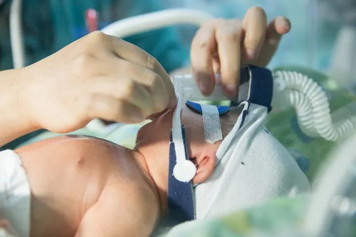 好医生日志|出生后呼吸困难，他们该如何活下去？