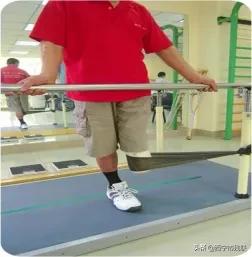 简单的截肢方法,截肢物理治疗