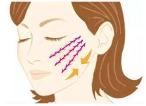 线雕后多久可以用射频仪,线雕后多久可以去美容院做脸