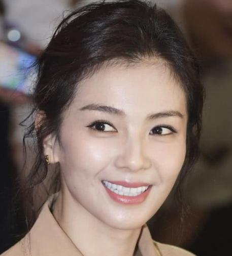 烤瓷牙明星吴宣仪,娱乐圈中明星们的烤瓷牙