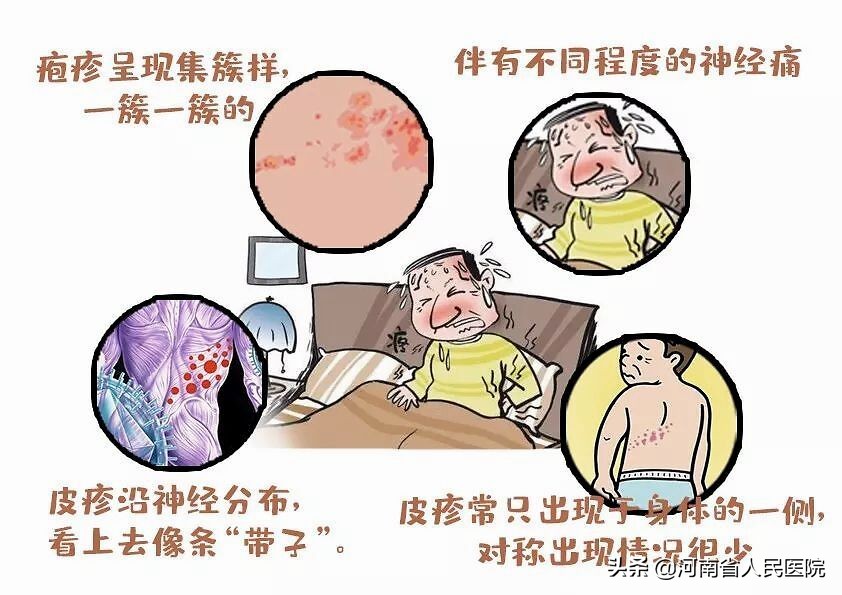 关于带状疱疹的7个错误认识,带状疱疹的十大误区