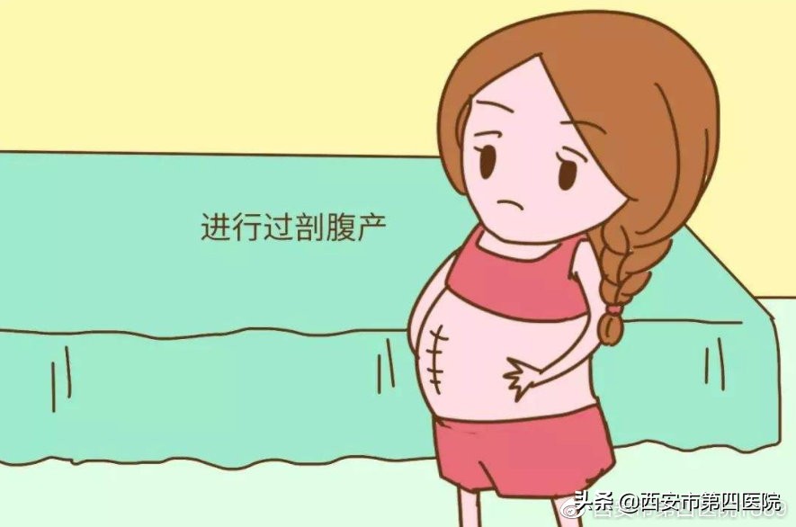 什么情况下选择剖腹产,什么情况可以选择剖腹产