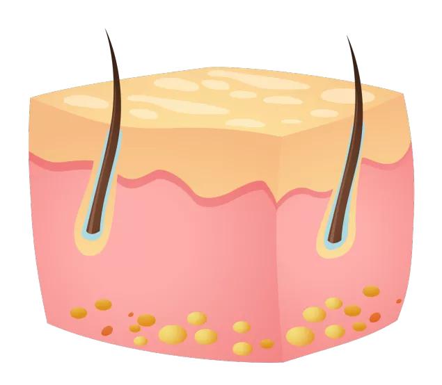 脱毛后总觉得冷飕飕的,脱毛后总觉得腋下粘粘的