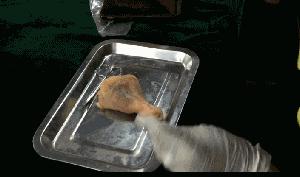 女子整容换脸后续,整容死亡真实案例