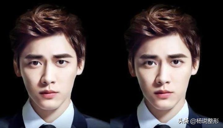 整形医生科普割双眼皮必看攻略,割双眼皮一定好看吗