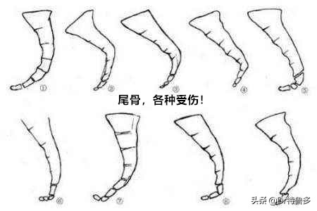 不明原因的尾骨痛怎么治疗最好,一坐下尾骨疼是怎么回事女性