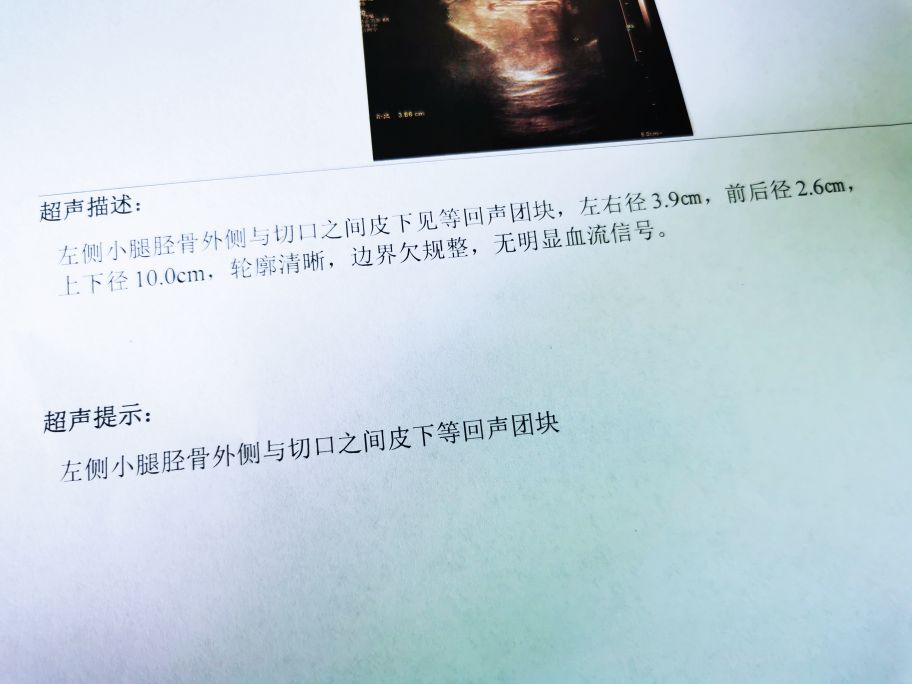 脂肪肉瘤和脂肪瘤怎么分辨,脂肪瘤很常见吗