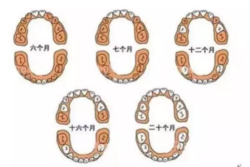 宝宝开始出牙需要注意什么,宝宝出牙顺序有什么