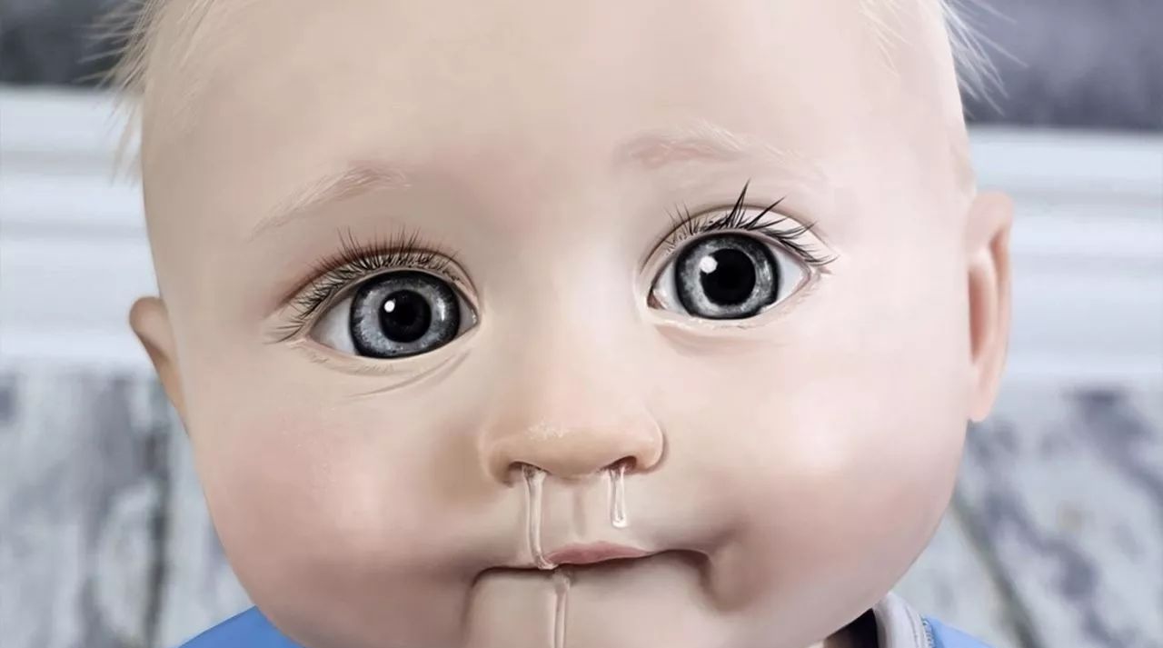 儿科医生治打喷嚏流鼻涕,儿科医生小孩流鼻涕