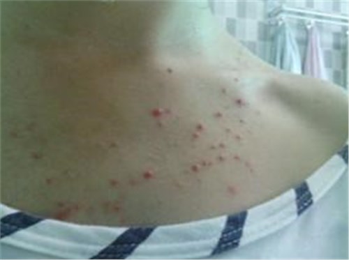 女生没事的时候多低头看看这个地方,越大越要引起重视