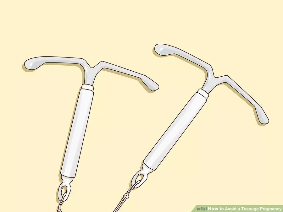 有没有外用避孕措施,有什么办法可以安全避孕吗