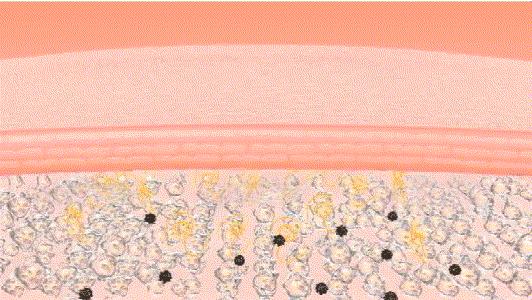 遮瑕遮不住雀斑怎么办,什么样的遮瑕可以遮掉雀斑