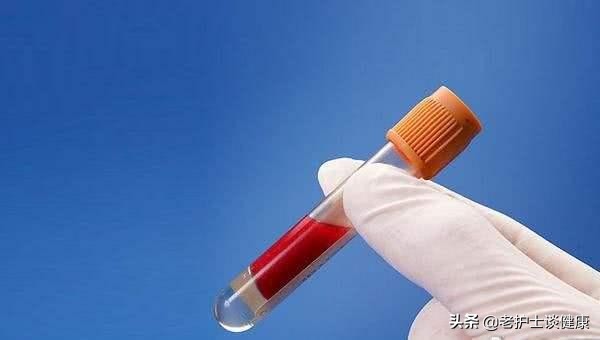 防高血脂的最好方法,高血脂的100个常识