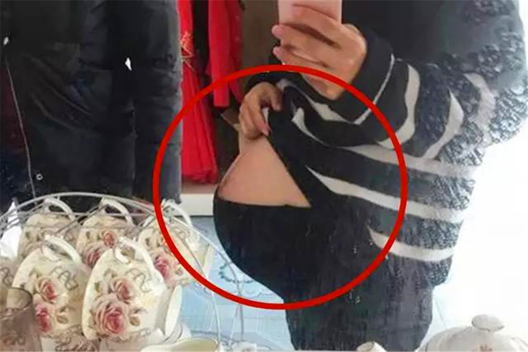 “悬垂肚”有多糟心？十有八九要剖腹产，还有这些生理尴尬在等待