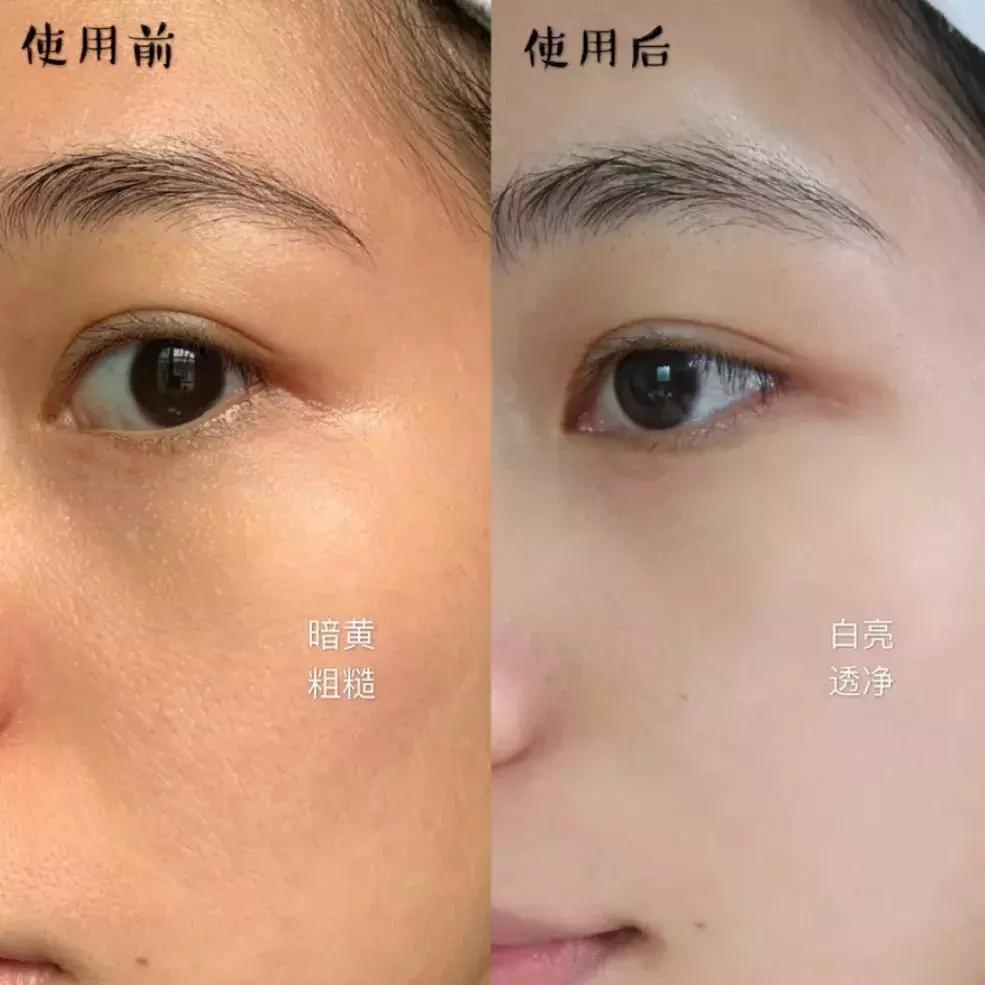 精华原液成分怎么选,精华好用的成分推荐