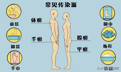 如何杀菌治脚气，看这篇文章就对了