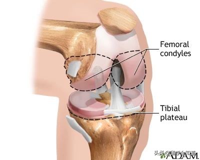 儿童运动损伤致残,如何避免运动损伤风险评估