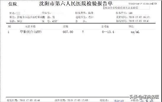 癌症晚期植入碘粒子,肝癌放射性粒子植入并发症