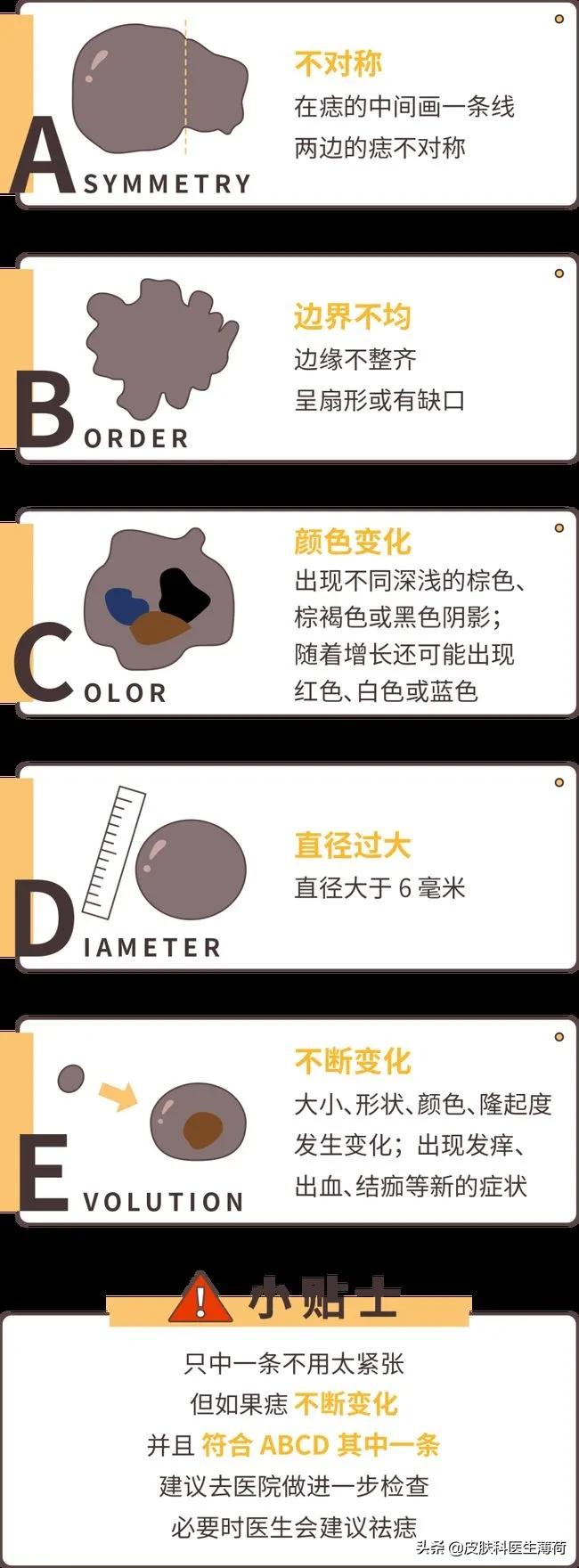 富贵痣点掉了,有福的痣点掉