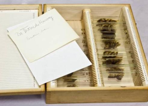 爱因斯坦大脑最后落到谁手上,爱因斯坦的大脑是不是最聪明的