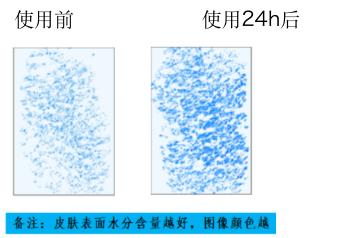 chkgene新风口,chk皮肤修复
