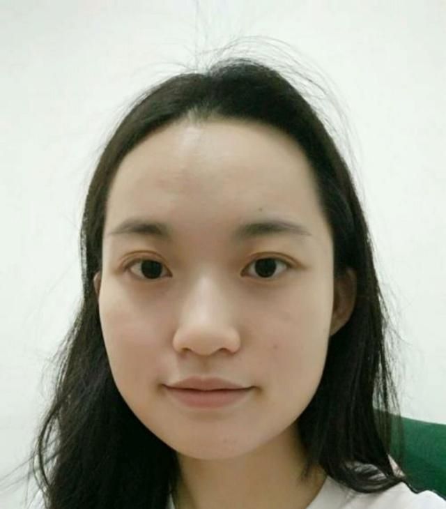 下巴丑如何解决,下巴长得丑怎么用自然方法改善