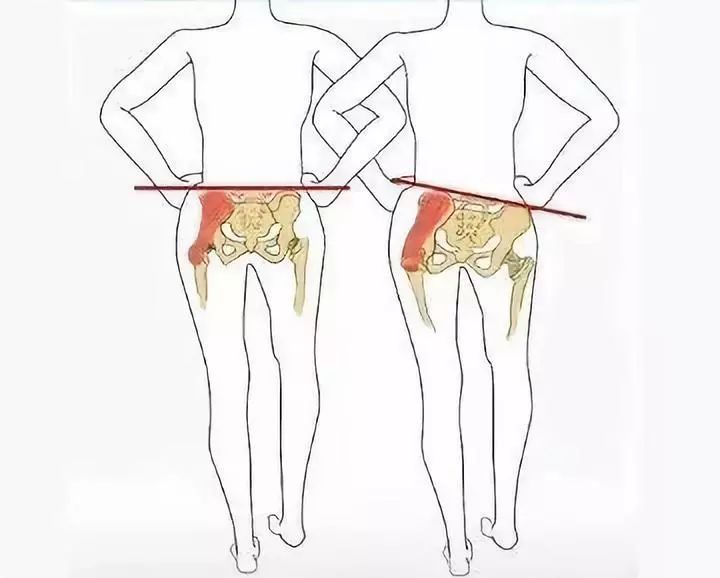 臀部不饱满，走路屁股摇来摇去？这块肌肉你一定要加强