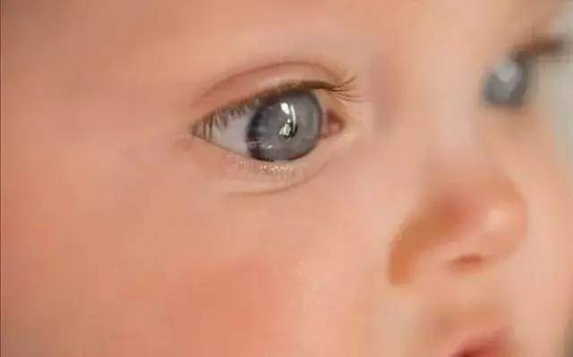 儿童有眼屎多且黄是怎么回事,小孩子突然眼屎多又黄粘稠怎么办