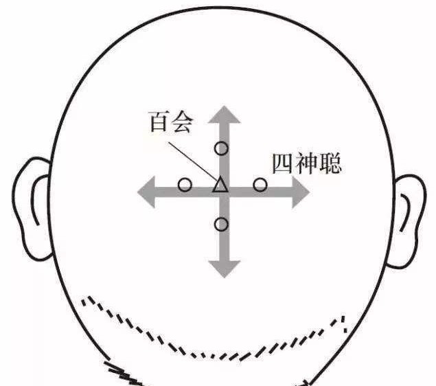 每天按捏这个穴位会使脑子聪明,四神聪穴在头顶哪个部位