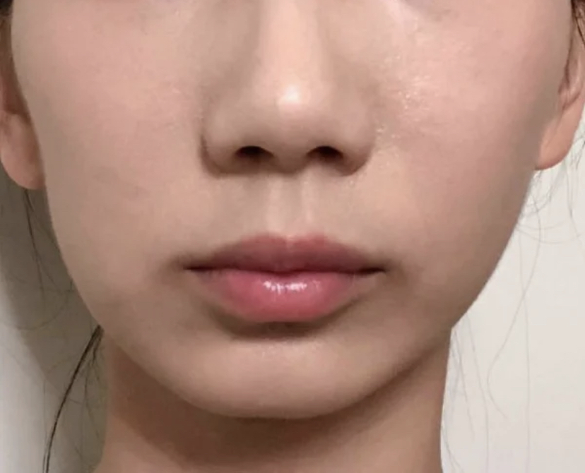 大小脸影响颜值怎么办,大小脸的影响