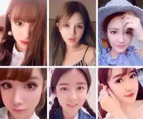 双眼皮整形的真实经历,为什么做双眼皮医生术前不沟通