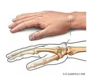 拉开筋最快方法,拉筋长寿老祖宗留下实用拉筋术