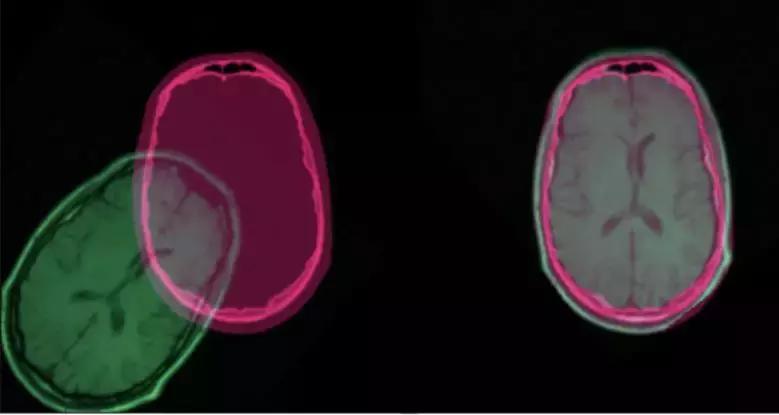 图像配准的前世今生：从人工设计特征到深度学习