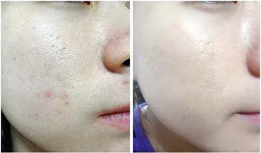 宋慧乔为何可以红这么多年,宋慧乔何穗惊艳亮相