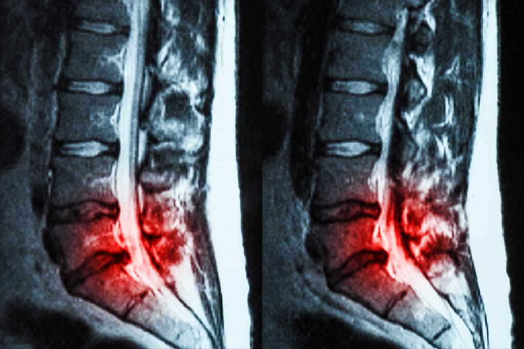 排尿困难是肾的问题吗,排尿困难是肾炎吗
