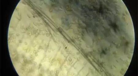 南美白对虾肠道细吃料慢,南美白对虾生长缓慢怎么解决