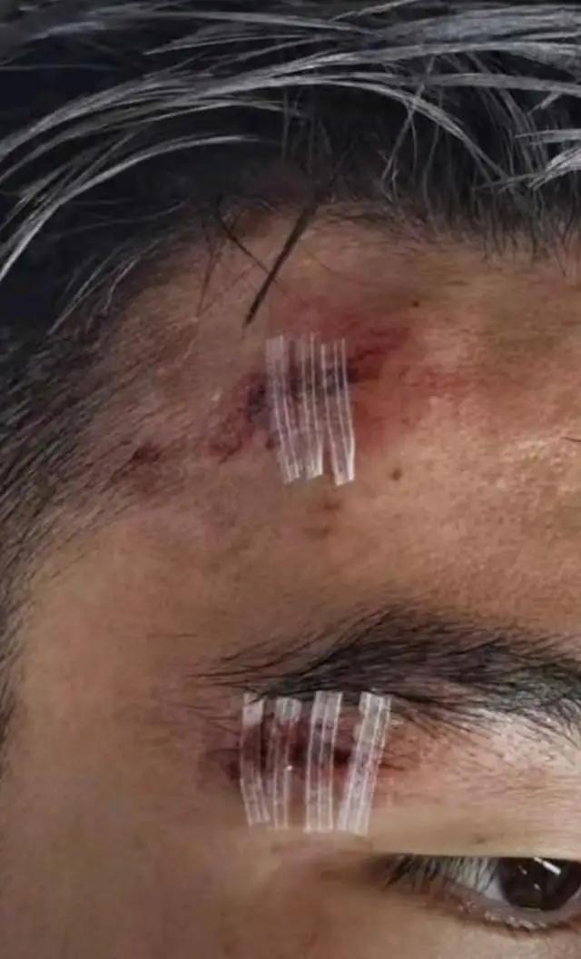 拳击比赛中国裁判怒踹日本拳手,日本拳手恶意犯规视频