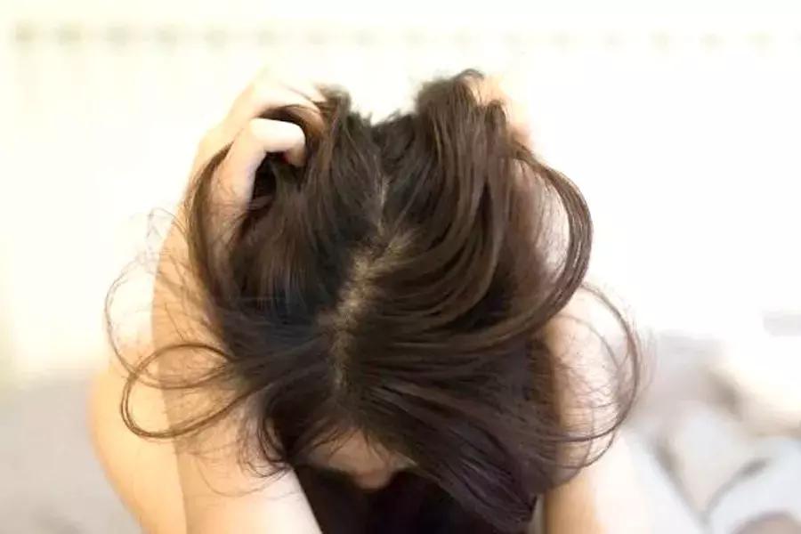 防掉发最好的修复方法,备受掉发困扰试试这些防脱发秘笈