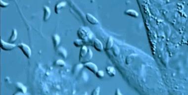 猫咪身上有绦虫人会感染吗,猫咪身上一定有弓形虫吗