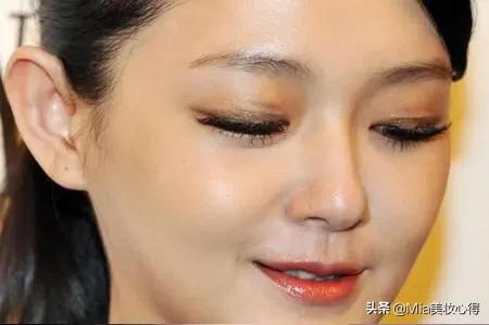 长期贴双眼皮贴的女生，后来怎么样了？教你一招避免眼皮松弛