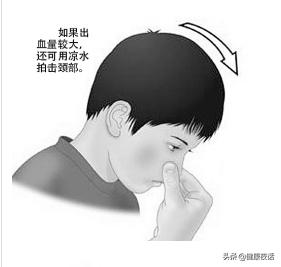 孩子流鼻血怎么办最有效的方法,孩子流鼻血怎么办最有效方法