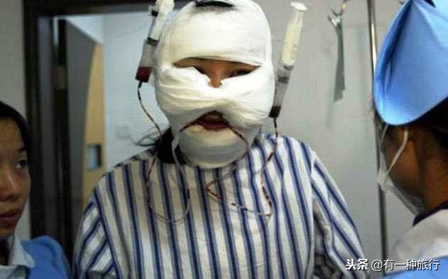 泰国人妖是变性手术还是打激素,泰国人妖变女性要经过哪些手术